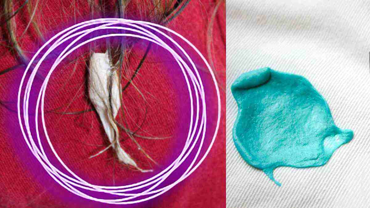 Voici 10 astuces infaillibles pour enlever le chewinggum sur vos vêtements ! Astuces au feminin
